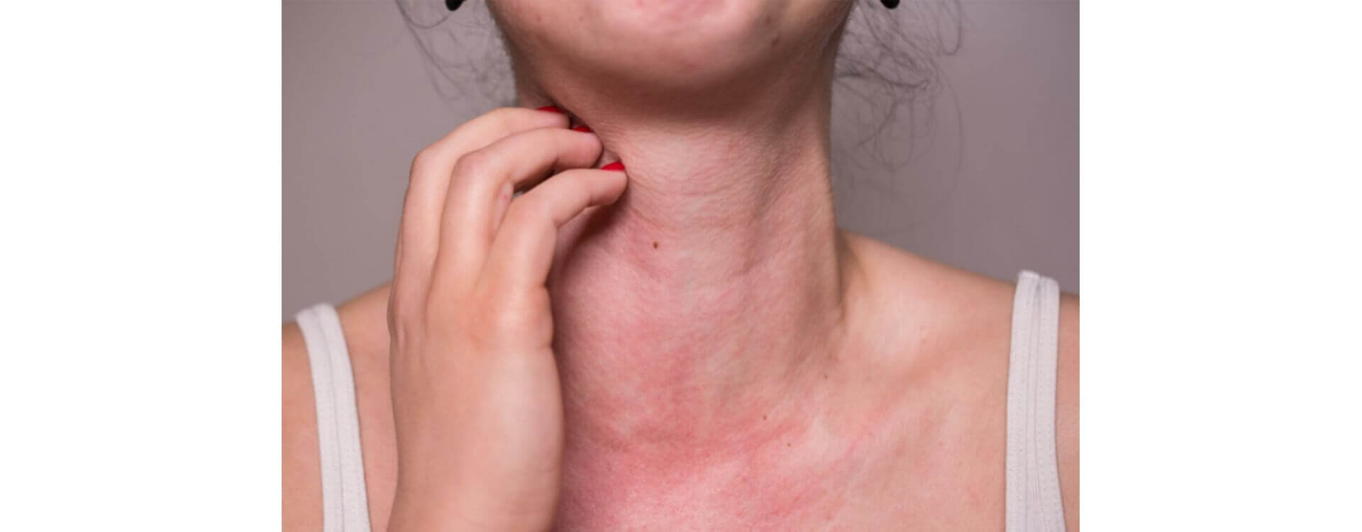 Top 99+ imagen allergie au fond de teint que faire fr.thptnganamst.edu.vn